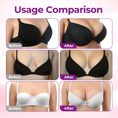 🎁Alcuras® Targeted Breast Enhancement Advanced Nano Microneedle Patch