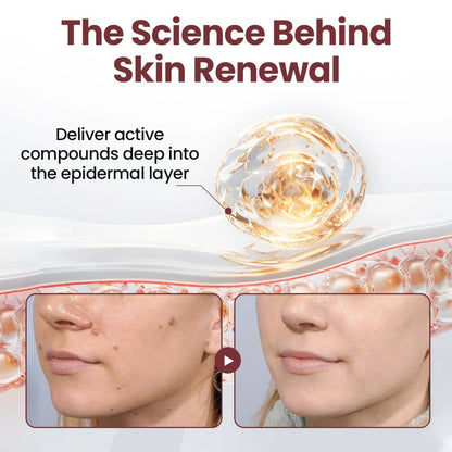 Alcuras™ KeraErase Dual-Action Renewal Cream